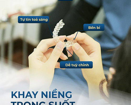 Đánh giá 5 cách làm răng đều không cần niềng hiện nay Đánh giá 5 cách làm răng đều không cần niềng hiện nay