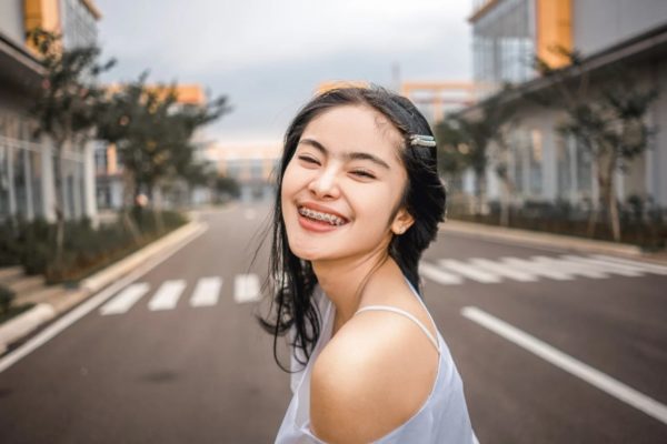 Niềng răng có phun môi được không? Niềng răng có phun môi được không?
