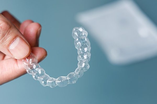 Nhược điểm của niềng răng Invisalign là gì?