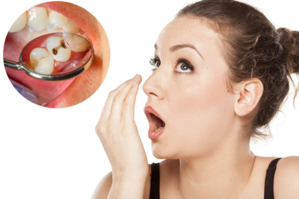 Hỏi đáp – nhổ răng sâu có hết hôi miệng không?
