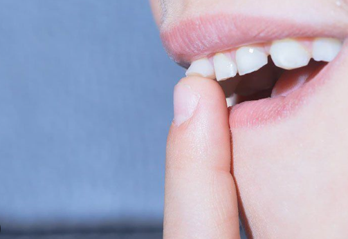 Răng sữa của trẻ bị lung lay